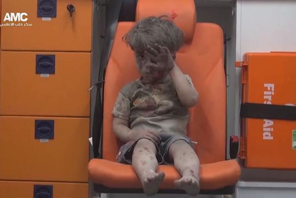 Imagem de criança ferida após ataque em Aleppo choca o mundo