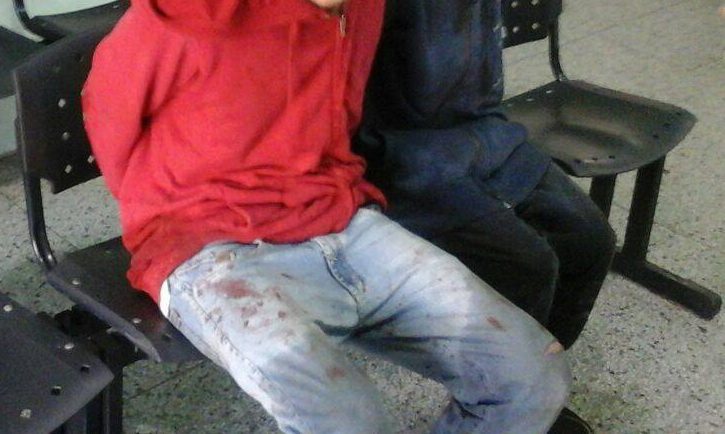 Idoso é agredido com garrafadas, chutes e pedradas durante assalto no Litoral