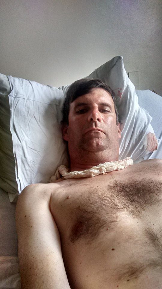 Jornalista alvo de bala perdida em Osório posta foto de sua recuperação