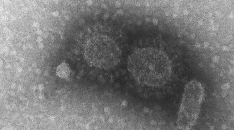 Litoral tem duas novas mortes e 1280 casos ativos de coronavírus