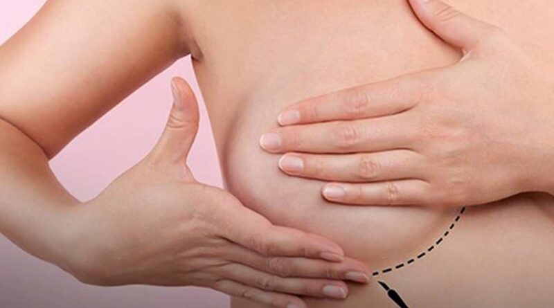 Femama alerta sobre mamografias após vacina contra covid-19