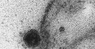 Mundo registra primeiro caso de dupla infecção de gripe e covid-19, a chamada "flurona"