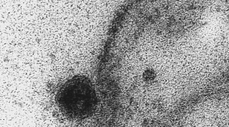 Estudo diz que novo coronavírus infecta e se replica em glândulas salivares