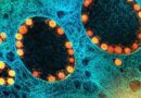 Aumenta em 6 vezes os casos confirmados de coronavírus no Litoral