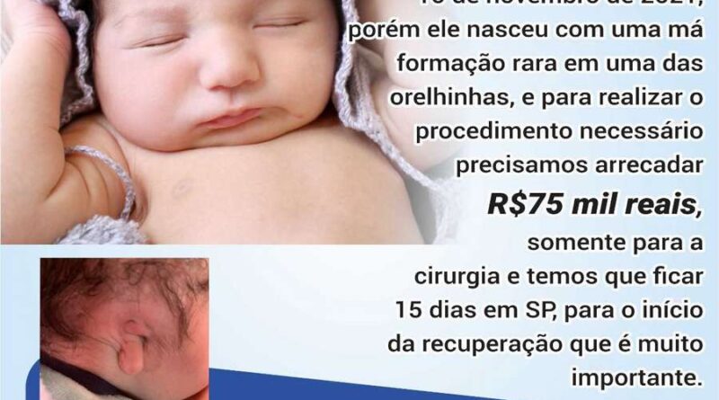 Moradores de Osório fazem campanha para arrecadar R$ 75mil para cirurgia do filho