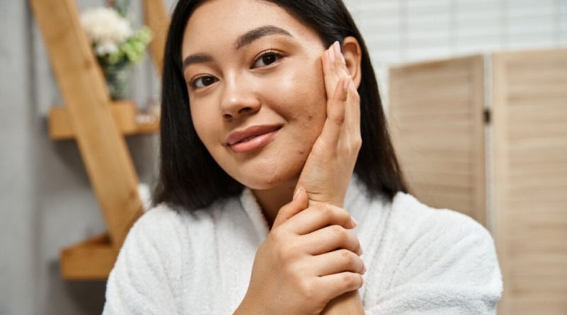 Veja como tratar as marcas deixadas pela acne